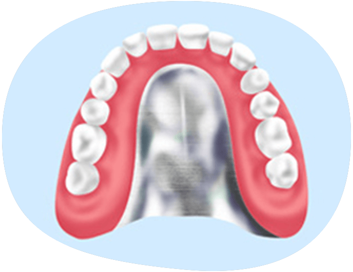 自費入れ歯